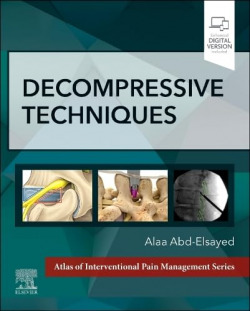 Decompressive techniques