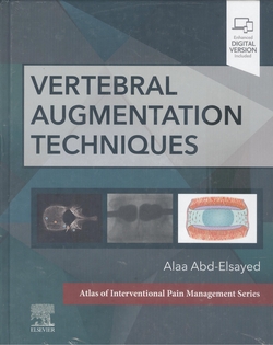 Vertebral augmentation techniques