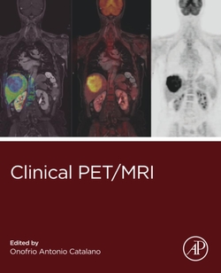 CLINICAL PET/MRI