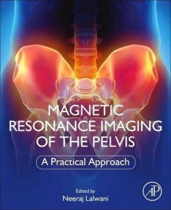 Magnetic resonance imaging of the pelvis