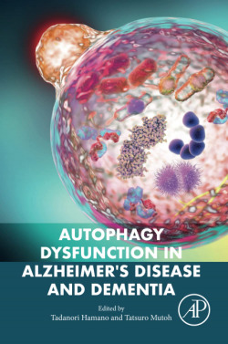 AUTOPHAGY DYSFUNCTION IN ALZHEIMER'S DISEASE DEMENTIA