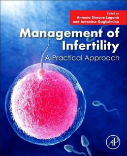 Management of infertility:a practical approach