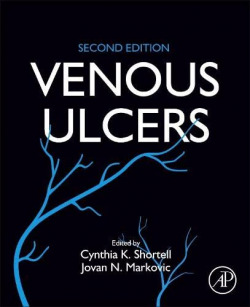 Venous ulcers