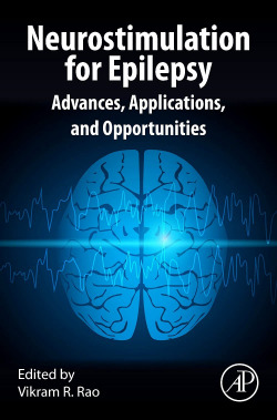 NEUROSTIMULATION FOR EPILEPSY
