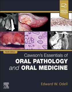 Cawson´s essentials of oral pathology and oral medicine