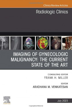 Imaging of gynecologic malignancy: the current state of the