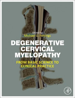 Degenerative cervical myelopathy:from basic science practic