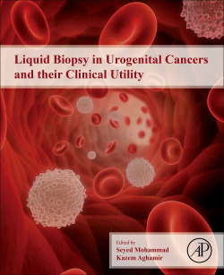 LIQUID BIOPSY UROGENITAL CANCERS AND ITS CLINICAL UTILITY