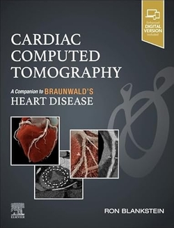 Cardiac computed tomography:a companion braunwald´s