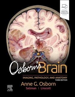 OSBORN'S BRAIN 3RD.EDITION