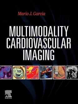 Multimodality cardiovascular imaging