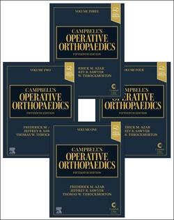 (4 vol).campbell's operative orthopaedics