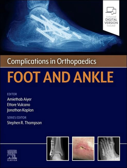 Complications in orthopaedics:foot and ankle