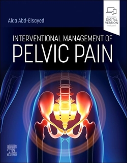 Interventional management of pelvic pain