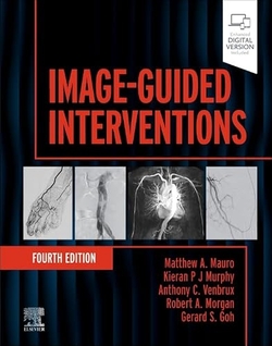 Image-guided interventions
