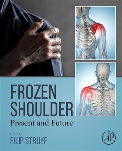 Frozen shoulder