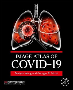 Image atlas of covid-19