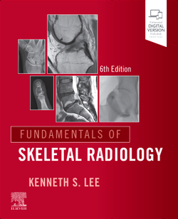 FUNDAMENTALS OS SKELETAL RADIOLOGY