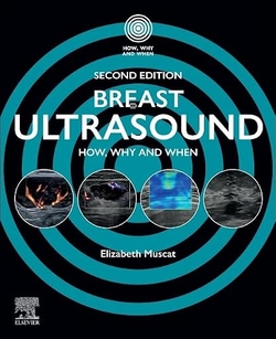 Breast ultrasound