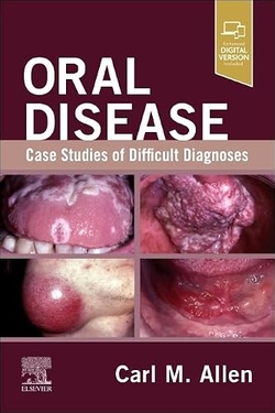 ORAL DISEASE:CASE STUDIES OF DIFFICULT DIAGNOSES