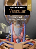 Diagnostic ultrasound:vascular
