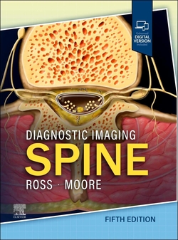 DIAGNOSTIC IMAGING: SPINE