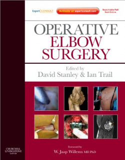 Operative Elbow Surgery