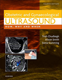 Obstetric & Gynecological Ultrasound
