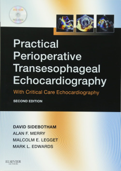 Practical Perioperative Transesophageal Echocardiography