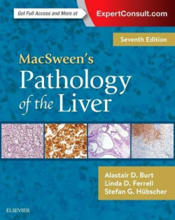 MACSWEEN'S PATHOLOGY OF THE LIVER.(7TH EDITION)