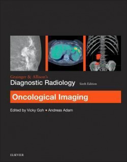 Grainger & AllisonÆs Diagnostic Radiology: Oncological Imaging