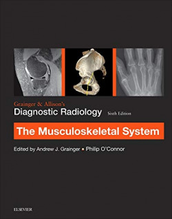 Grainger & AllisonÆs Diagnostic Radiology: Musculoskeletal System