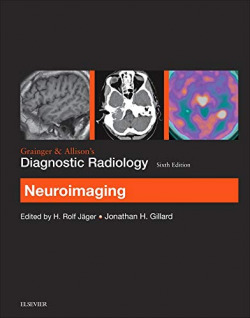 Grainger & AllisonÆs Diagnostic Radiology: Neuroimaging