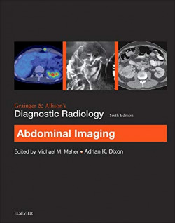 Grainger & AllisonÆs Diagnostic Radiology: Abdominal Imaging