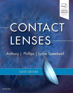 CONTACT LENSES