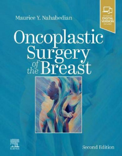 Oncoplastic surgery of the breast