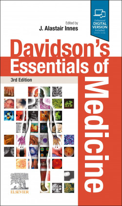 Davidson´s essentials of medicine