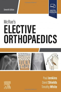 McraeÆs elective orthopaedics