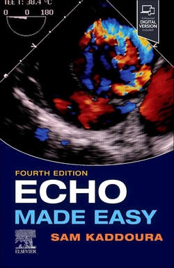 Echo made easy