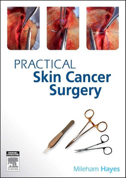 PRACTICAL SKIN CANCER SURGERY