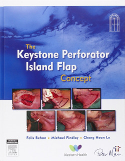 The Keystone Perforator Island Flap Concept