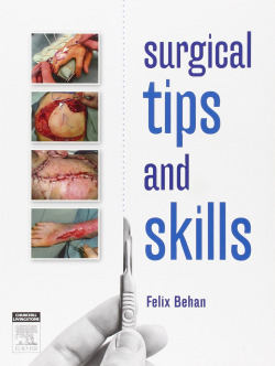 Surgical Tips and Skills
