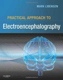 PRACTICAL APPROACH TO ELECTROENCEPHALOGRAPHY