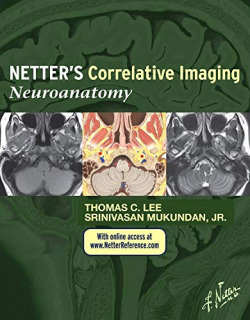 NetterÆs Correlative Imaging: Neuroanatomy