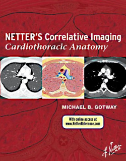 NetterÆs Correlative Imaging: Cardiothoracic Anatomy