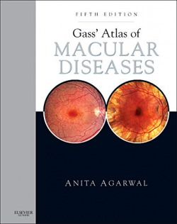 Gass' Atlas of Macular Diseases