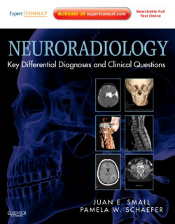 Neuroradiology: Key Differential Diagnoses and Clinical Questions