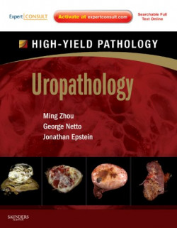 Uropathology