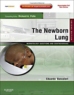 The Newborn Lung: Neonatology Questions and Controversies