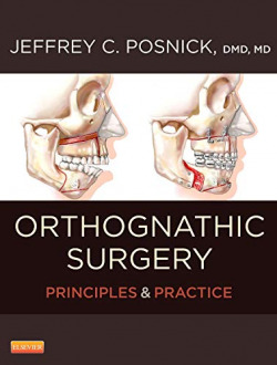 Orthognathic Surgery - 2 Volume Set